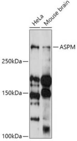 ASPM Antibody - Azide and BSA Free, Novus Biologicals 0.02 mL, Unconjugated:Antibodies,