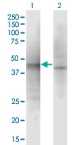 ASZ1 Antibody (3C9), Novus Biologicals 0.1 mg; Unconjugated:Antibodies,