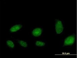 ATAD2 Antibody, Novus Biologicals 0.05 mg | Buy Online | Novus Biologicals | Fisher Scientific