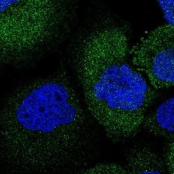 ATAT1 Antibody, Novus Biologicals 25 &mu;L, Unconjugated:Antibodies, Polyclonal