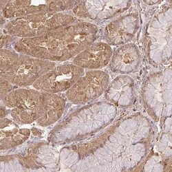 ATAT1 Antibody, Novus Biologicals 25 &mu;L, Unconjugated:Antibodies, Polyclonal