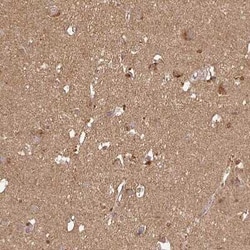 ATAT1 Antibody, Novus Biologicals 25 &mu;L, Unconjugated:Antibodies, Polyclonal