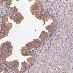 ATAT1 Antibody, Novus Biologicals 25 &mu;L, Unconjugated:Antibodies, Polyclonal