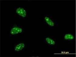 ATBF1/ZFHX3 Antibody (3B1), Novus Biologicals 0.1 mg, Unconjugated:Antibodies,