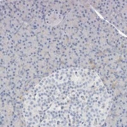 ATCAY Antibody, Novus Biologicals 25 &mu;L, Unconjugated:Antibodies, Polyclonal