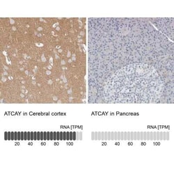 ATCAY Antibody, Novus Biologicals 25 &mu;L, Unconjugated:Antibodies, Polyclonal