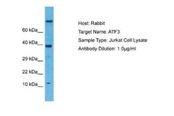 ATF3 Antibody, Novus Biologicals 100 &mu;L; Unconjugated:Antibodies, Polyclonal