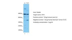 ATF3 Antibody, Novus Biologicals 100 &mu;L; Unconjugated:Antibodies, Polyclonal