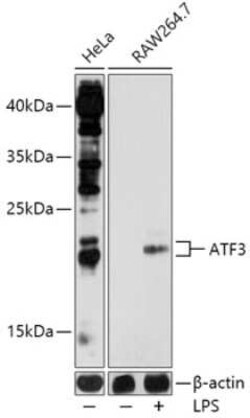 ATF3 Antibody - BSA Free, Novus Biologicals:Anticuerpos:Anticuerpos primarios