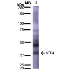 ATF4 Antibody (S360A-24), Novus Biologicals 0.025 mg; Unconjugated:Antikörper