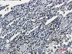 ATF6 Rabbit anti-Human, Clone: S05-4E7, Novus Biologicals:Antibodies:Primary