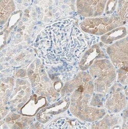 ATF6 Antibody, Novus Biologicals 25 &mu;L, Unconjugated:Antibodies, Polyclonal