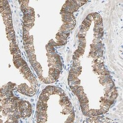 ATF6 Antibody, Novus Biologicals 25 &mu;L, Unconjugated:Antibodies, Polyclonal