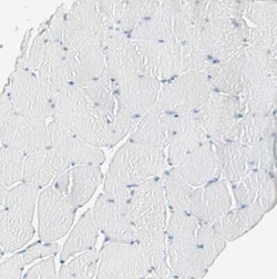 ATF6 Antibody, Novus Biologicals 25 &mu;L, Unconjugated:Antibodies, Polyclonal