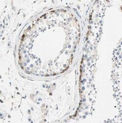 ATF6 Antibody, Novus Biologicals 25 &mu;L, Unconjugated:Antibodies, Polyclonal