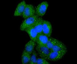 ATF7 Rabbit anti-Human, Clone: JJ2-072, Novus Biologicals 100&mu;L:Antibodies,