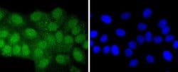 ATF7 Rabbit anti-Human, Clone: JJ2-072, Novus Biologicals 100&mu;L:Antibodies,