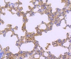 ATF7 Rabbit anti-Human, Clone: JJ2-072, Novus Biologicals 100&mu;L:Antibodies,