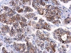 ATG10 Antibody, Novus Biologicals 100 &mu;g; Unconjugated:Antibodies, Polyclonal