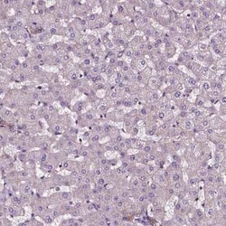 ATG16L1 Antibody, Novus Biologicals:Antibodies:Primary Antibodies