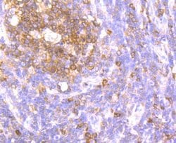 ATG3/APG3 Rabbit anti-Human, Mouse, Rat, Clone: JU00-35, Novus Biologicals