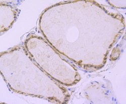 ATG3/APG3 Rabbit anti-Human, Mouse, Rat, Clone: JU00-35, Novus Biologicals