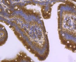 ATG3/APG3 Rabbit anti-Human, Mouse, Rat, Clone: JU00-35, Novus Biologicals