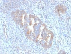 ATG5 Mouse anti-Human, Clone: ATG5/2101, Novus Biologicals 100 &mu;g; Unconjugated:Antibodies,