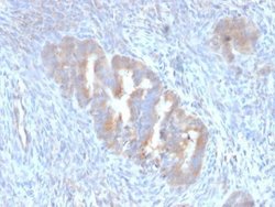 ATG5 Antibody (ATG5/2101) - Azide and BSA Free, Novus Biologicals 100 &mu;g | Buy Online | Novus Biologicals | Fisher Scientific