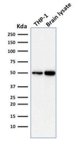 ATG5 Antibody (ATG5/2101) - Azide and BSA Free, Novus Biologicals 100 &mu;g | Buy Online | Novus Biologicals | Fisher Scientific