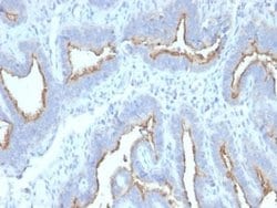 ATG5 Mouse anti-Human, Clone: ATG5/2492, Novus Biologicals:Antibodies:Primary