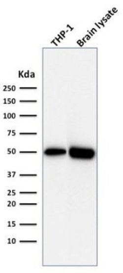 ATG5 Mouse anti-Human, Clone: ATG5/2492, Novus Biologicals:Antibodies:Primary