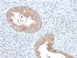 ATG5 Antibody (ATG5/2553) - Azide and BSA Free, Novus Biologicals 100 &mu;g | Buy Online | Novus Biologicals | Fisher Scientific