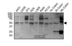 ATG5 Antibody - BSA Free, Novus Biologicals 0.1 mg; Unconjugated:Antibodies,