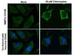 ATG9B Antibody, Novus Biologicals 100 μg; Unconjugated:Antibodies, Polyclonal