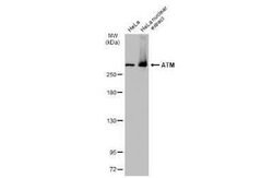 ATM Antibody (2C1-RB), Novus Biologicals 100 &mu;g; Unconjugated:Antibodies,