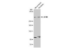 ATM Antibody (2C1-RB), Novus Biologicals 100 &mu;g; Unconjugated:Antibodies,