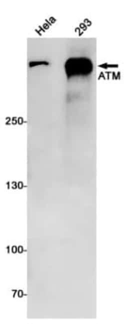 ATM Antibody (S08-8H3), Novus Biologicals 100 &mu;g | Buy Online | Novus Biologicals | Fisher Scientific