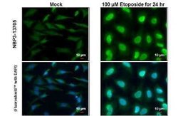 ATM, p Ser1981 Antibody (HL1062), Novus Biologicals 100 &mu;g | Buy Online | Novus Biologicals | Fisher Scientific