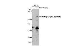 ATM, p Ser1981 Antibody (HL1062), Novus Biologicals 100 &mu;g | Buy Online | Novus Biologicals | Fisher Scientific