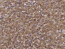 ATOX1 Antibody, Novus Biologicals 100 &mu;g | Buy Online | Novus Biologicals | Fisher Scientific