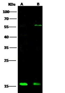 ATOX1 Antibody, Novus Biologicals 100 &mu;g | Buy Online | Novus Biologicals | Fisher Scientific