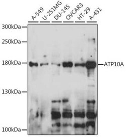 ATP10A Antibody - Azide and BSA Free, Novus Biologicals 0.1 mL, Unconjugated:Antibodies,