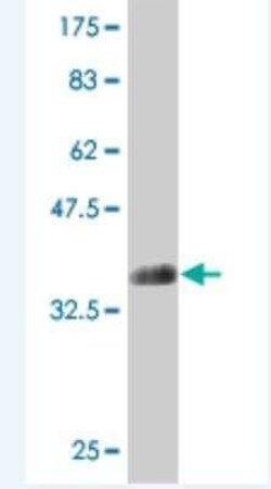 ATP11B Antibody (4H8), Novus Biologicals 0.1 mg | Buy Online | Novus Biologicals | Fisher Scientific