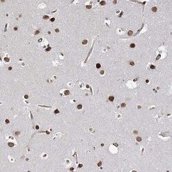 ATP11B Antibody, Novus Biologicals 0.1 mL; Unconjugated:Antibodies, Polyclonal