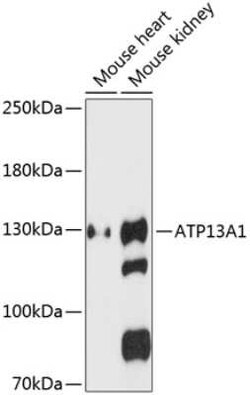 ATP13A1 Antibody - Azide and BSA Free, Novus Biologicals 0.1 mL, Unconjugated:Antibodies,
