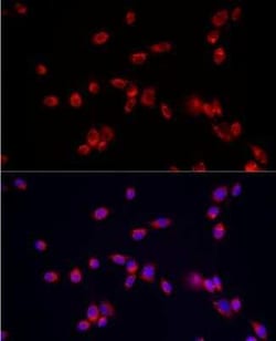 ATP13A2 Antibody - Azide and BSA Free, Novus Biologicals 0.02 mL | Buy Online | Novus Biologicals | Fisher Scientific