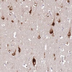 ATP13A2 Antibody, Novus Biologicals 25 &mu;L, Unconjugated:Anticuerpos