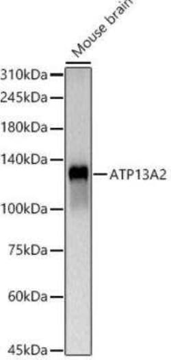 ATP13A2 Antibody - Azide and BSA Free, Novus Biologicals 0.02 mL | Buy Online | Novus Biologicals | Fisher Scientific