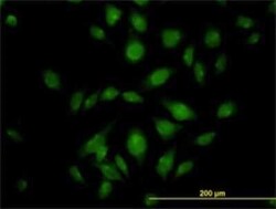 Novus Biologicals ATP2C1 Antibody (2G1), Novus Biologicals 0.1 mg | Buy Online | Novus Biologicals&trade; | Fisher Scientific